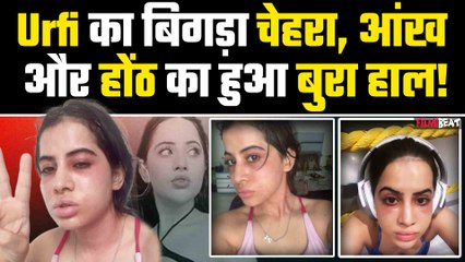 Urfi aka Uorfi Javed का बिगड़ गया पूरा चेहरा, जानें किस चक्कर से हुआ Actress का ये&nbsp;हाल|